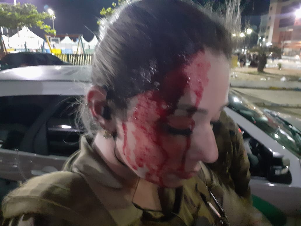 Policial militar ferida em confronto com arruaceiros em Laguna